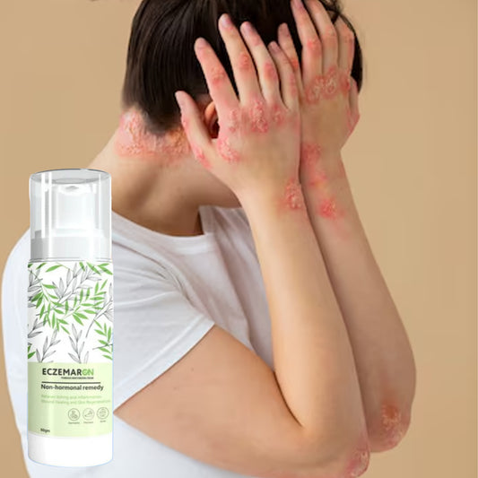 Herbal Eczemaron Relief Cream Soothing and Moisturizing (50 g)