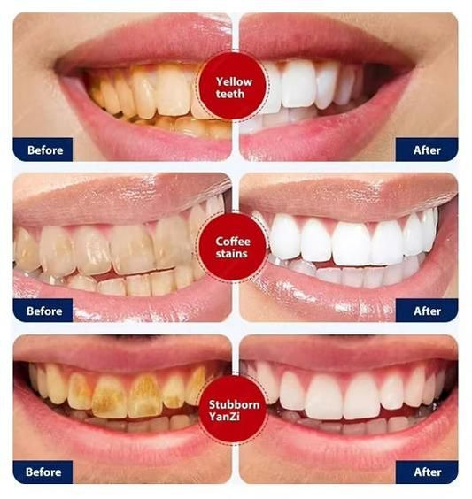 Smoke Stains White Plus Toothpaste 100g Pack of 1
