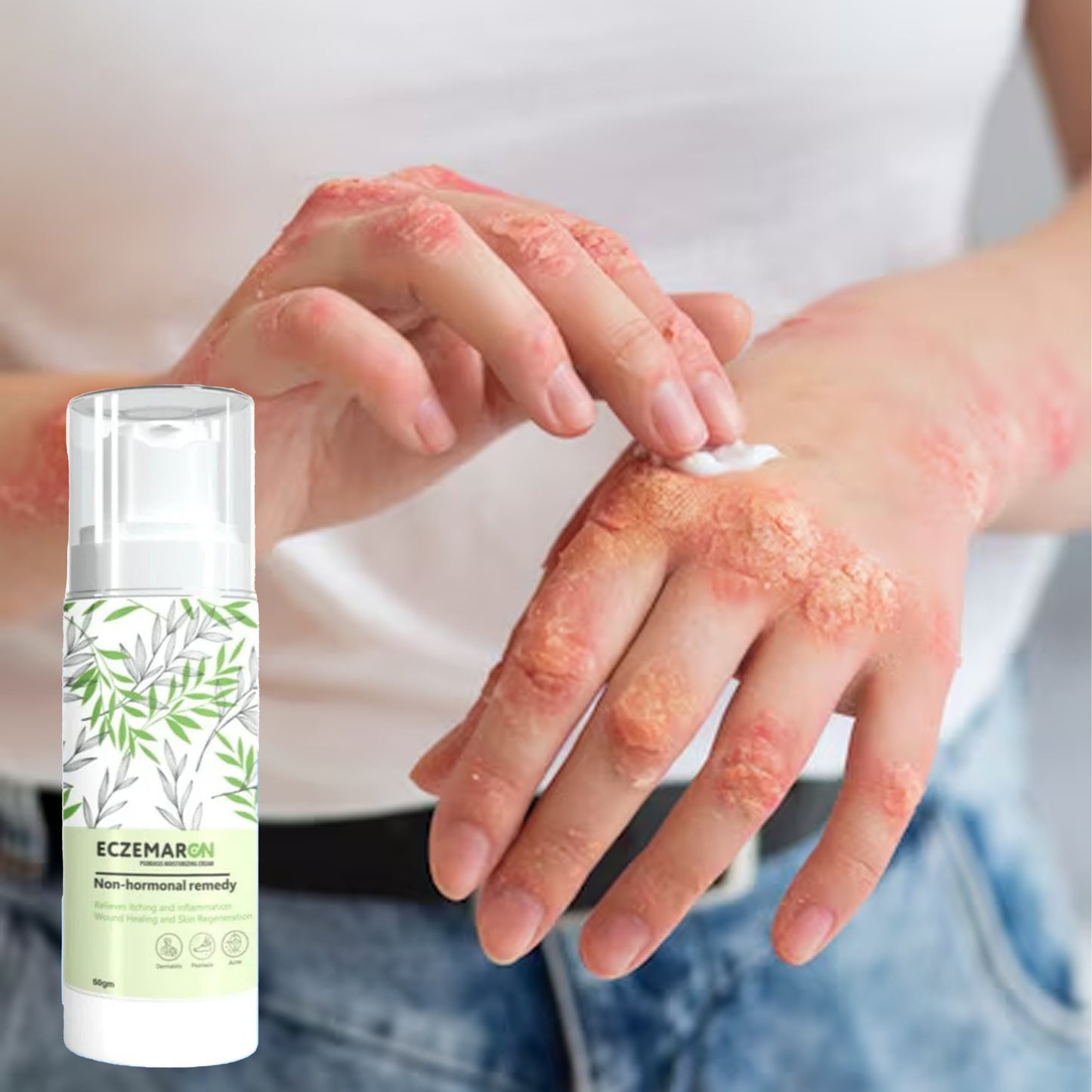 Herbal Eczemaron Relief Cream Soothing and Moisturizing (50 g)