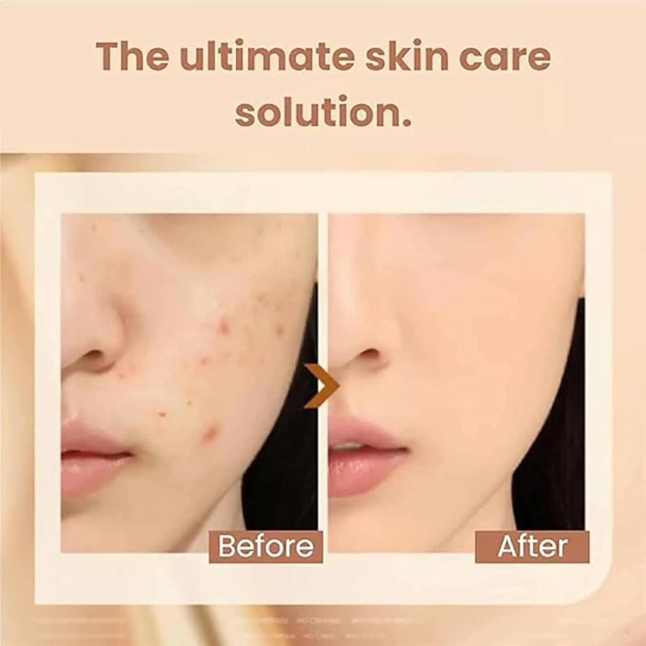 Double Head Foundation